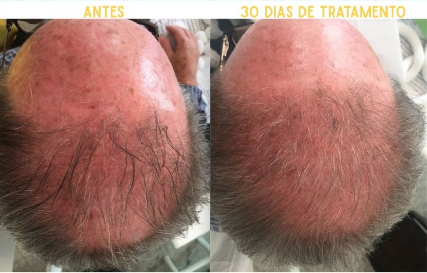 je_suis_resultados_1