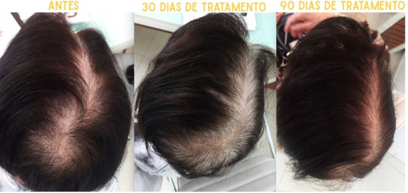 je_suis_resultados_2